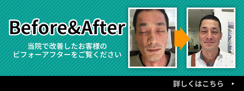 ビフォーアフター