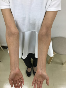 1年後