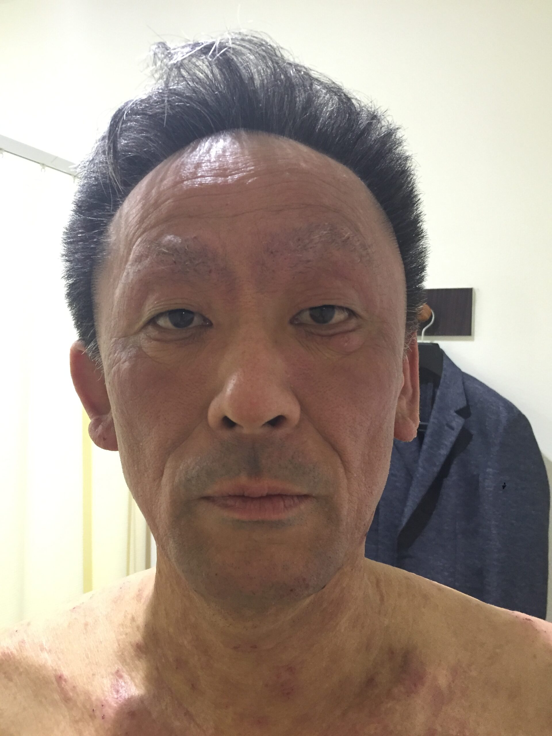 ビフォー写真