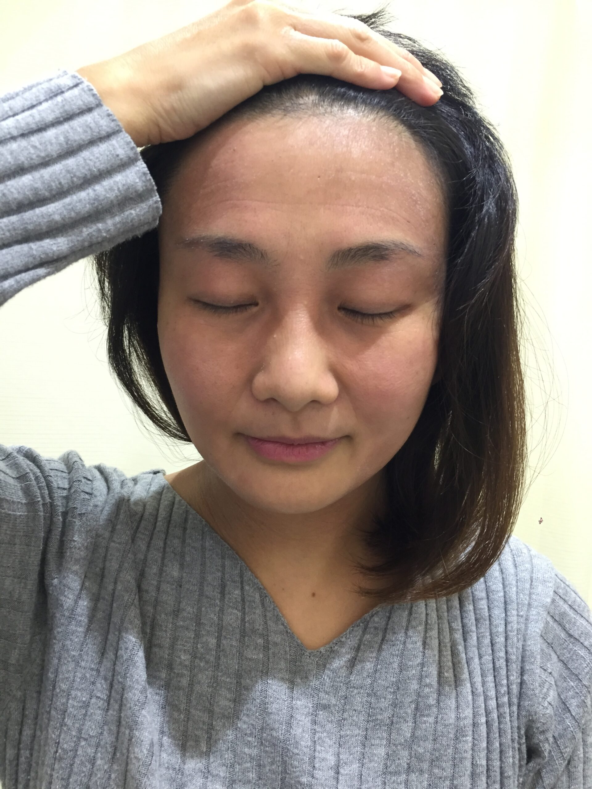 アフター写真