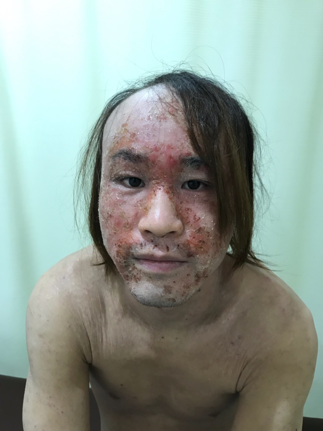 ビフォー写真