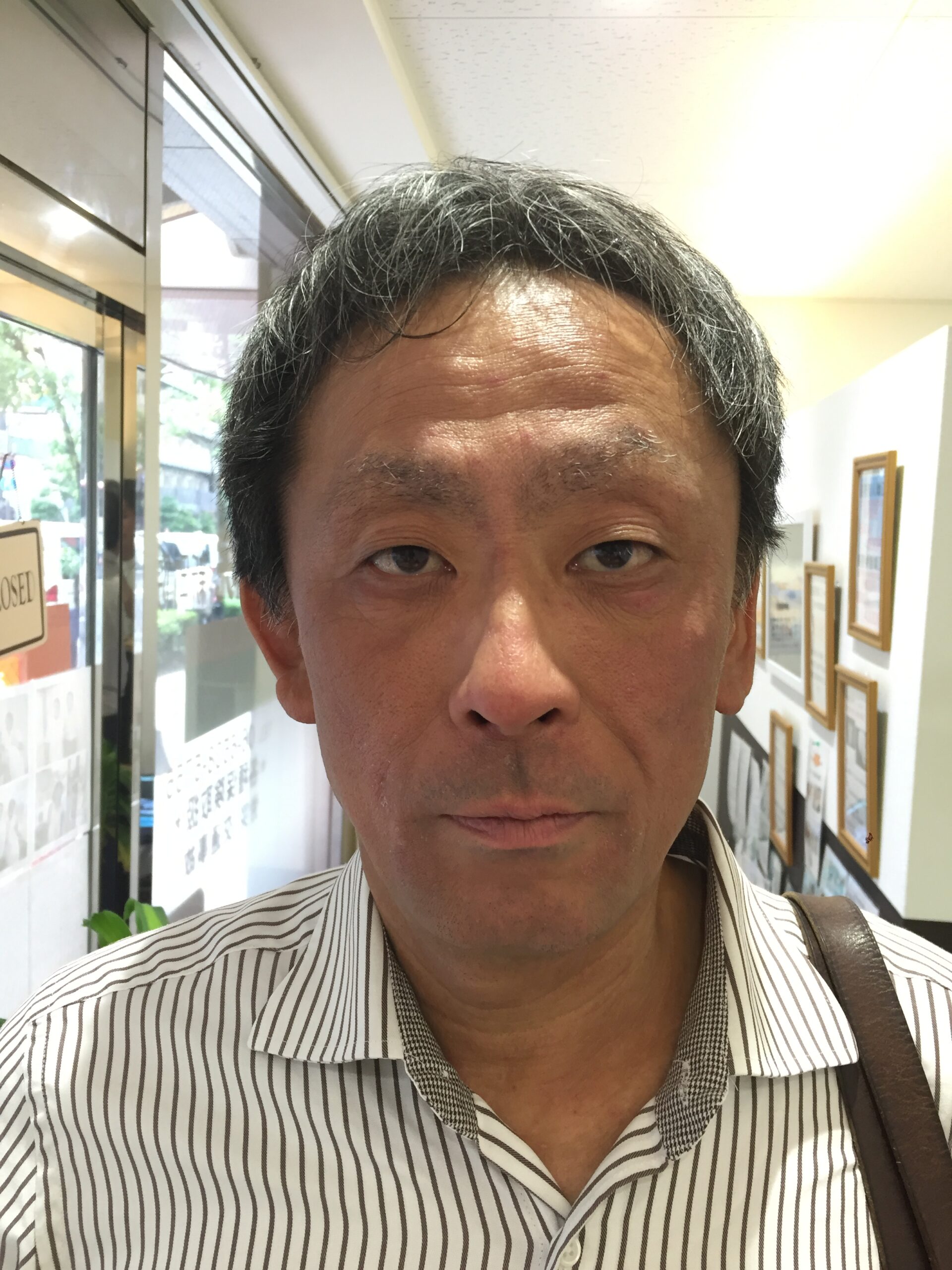 アフター写真