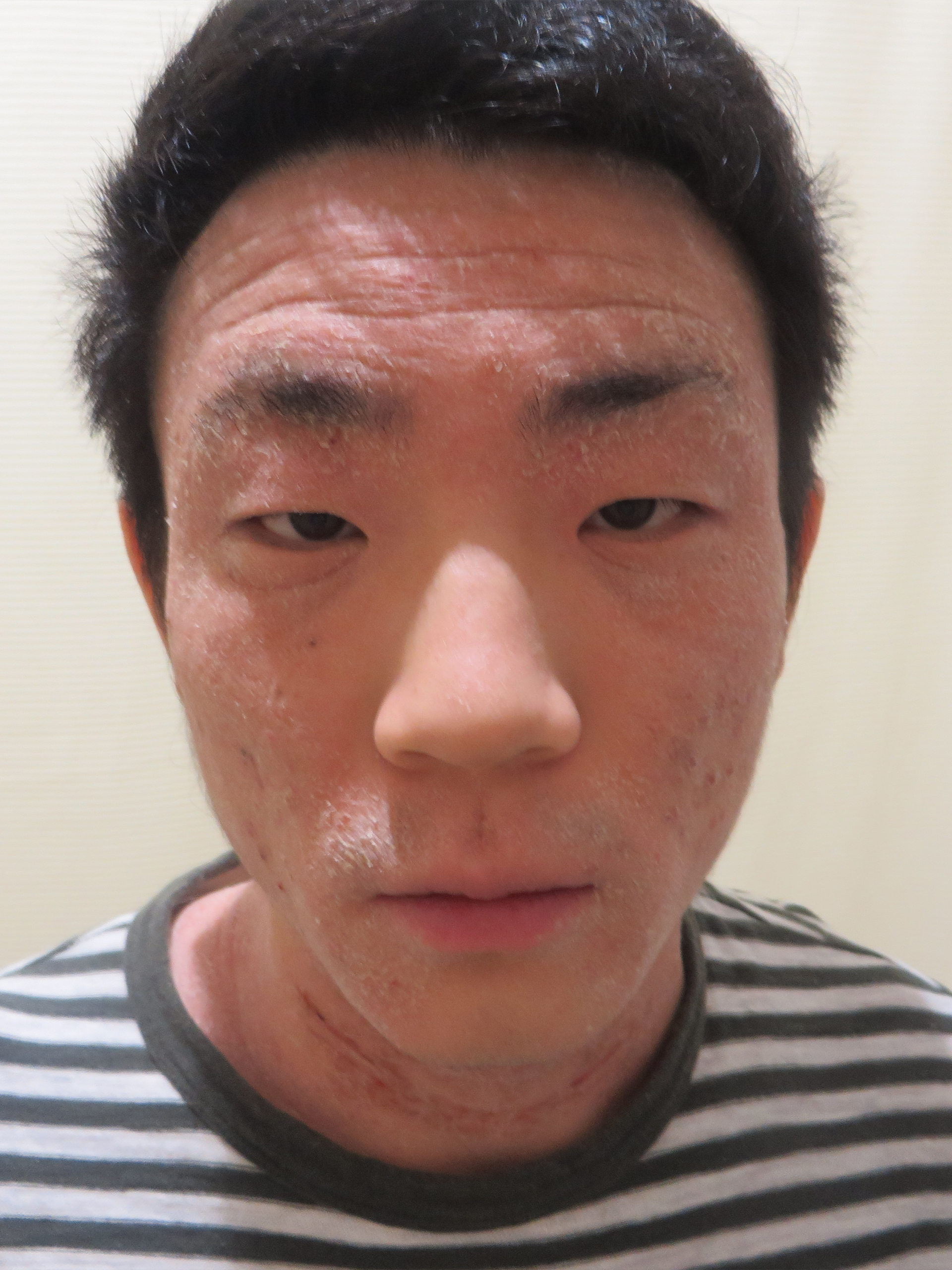 ビフォー写真