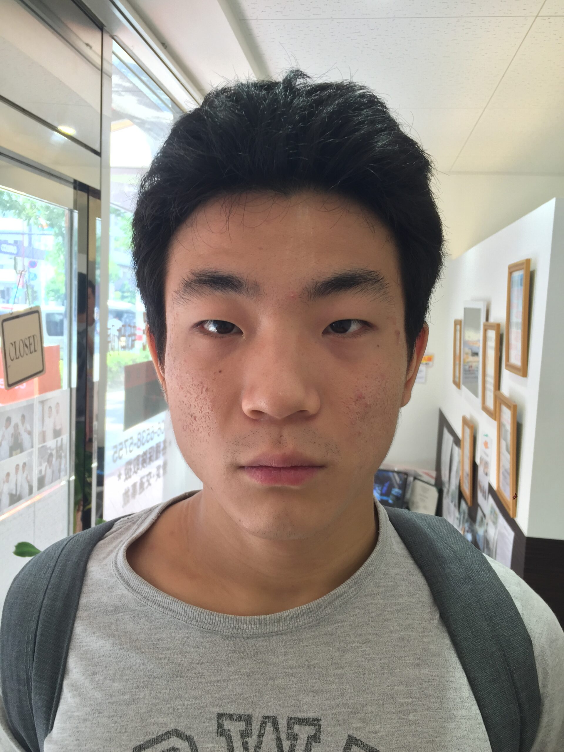 アフター写真