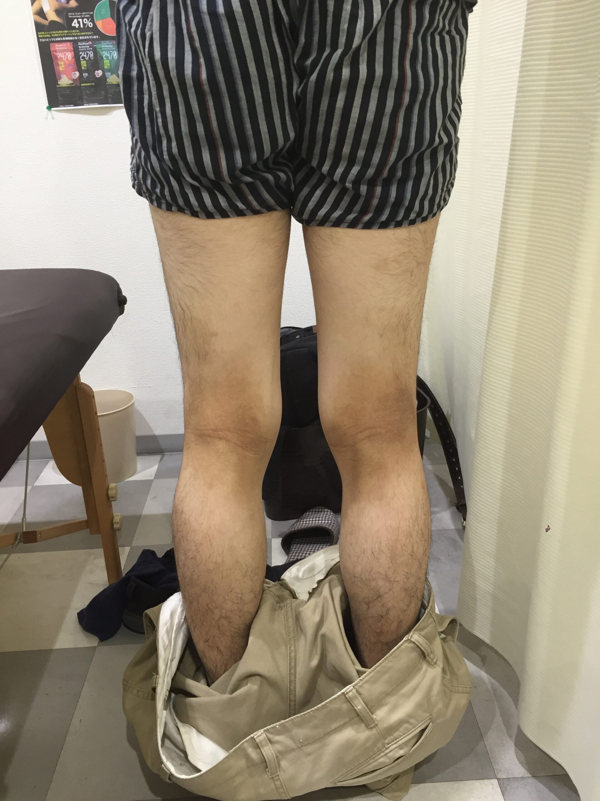 アフター写真
