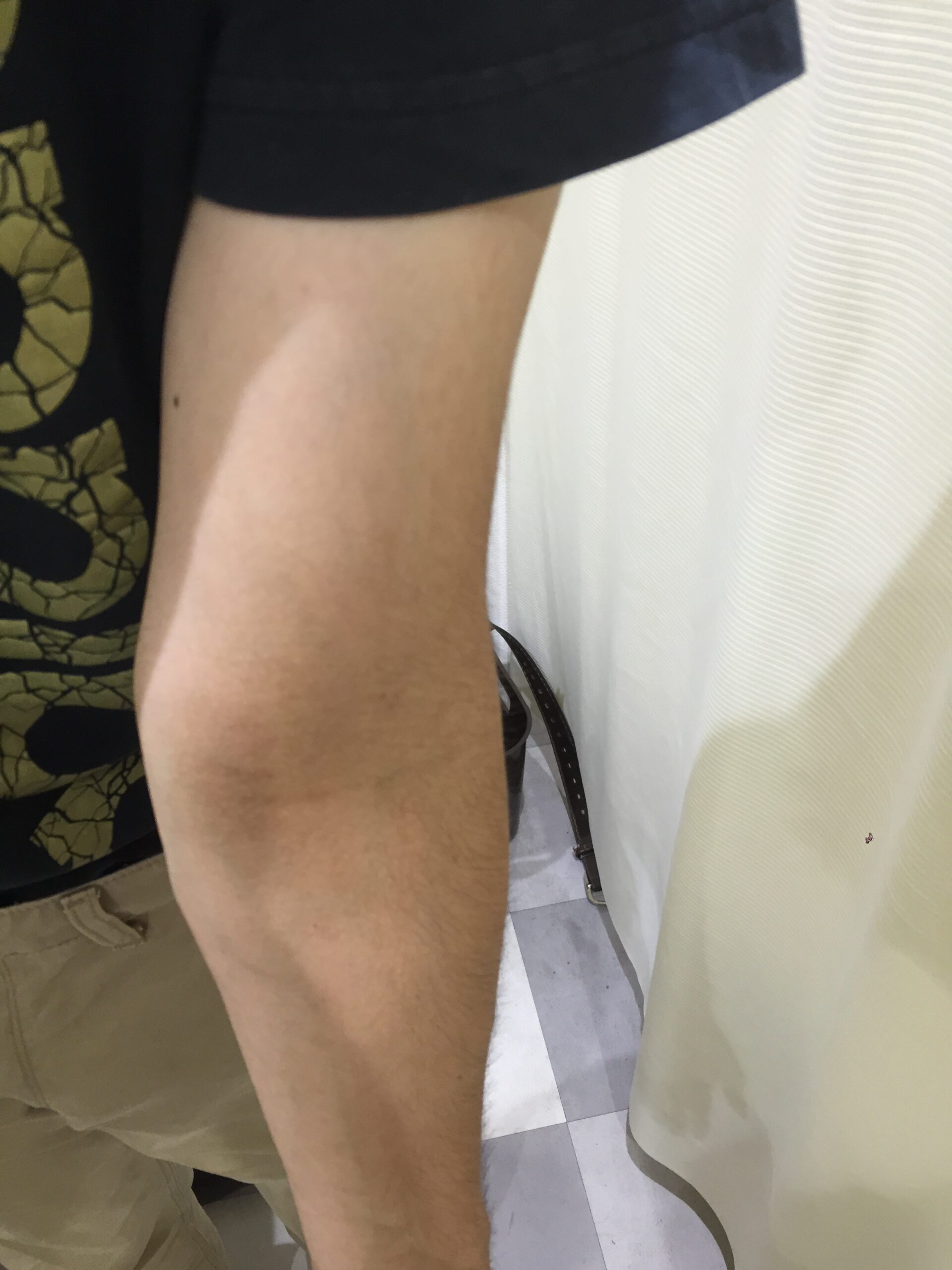 アフター写真