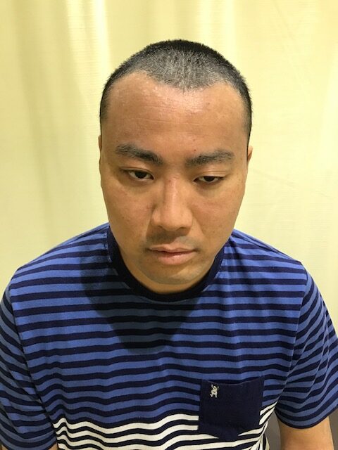 アフター写真