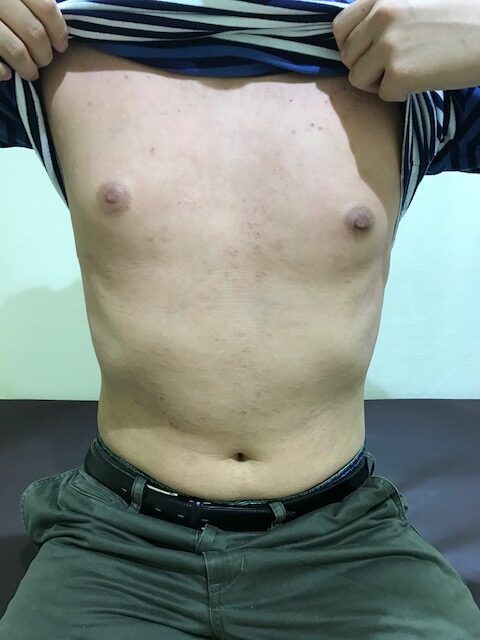 アフター写真