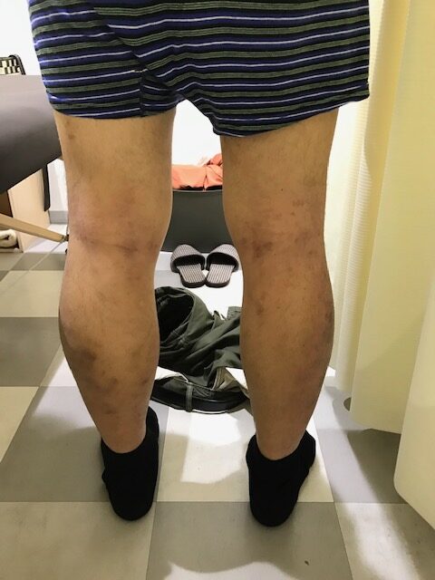 アフター写真