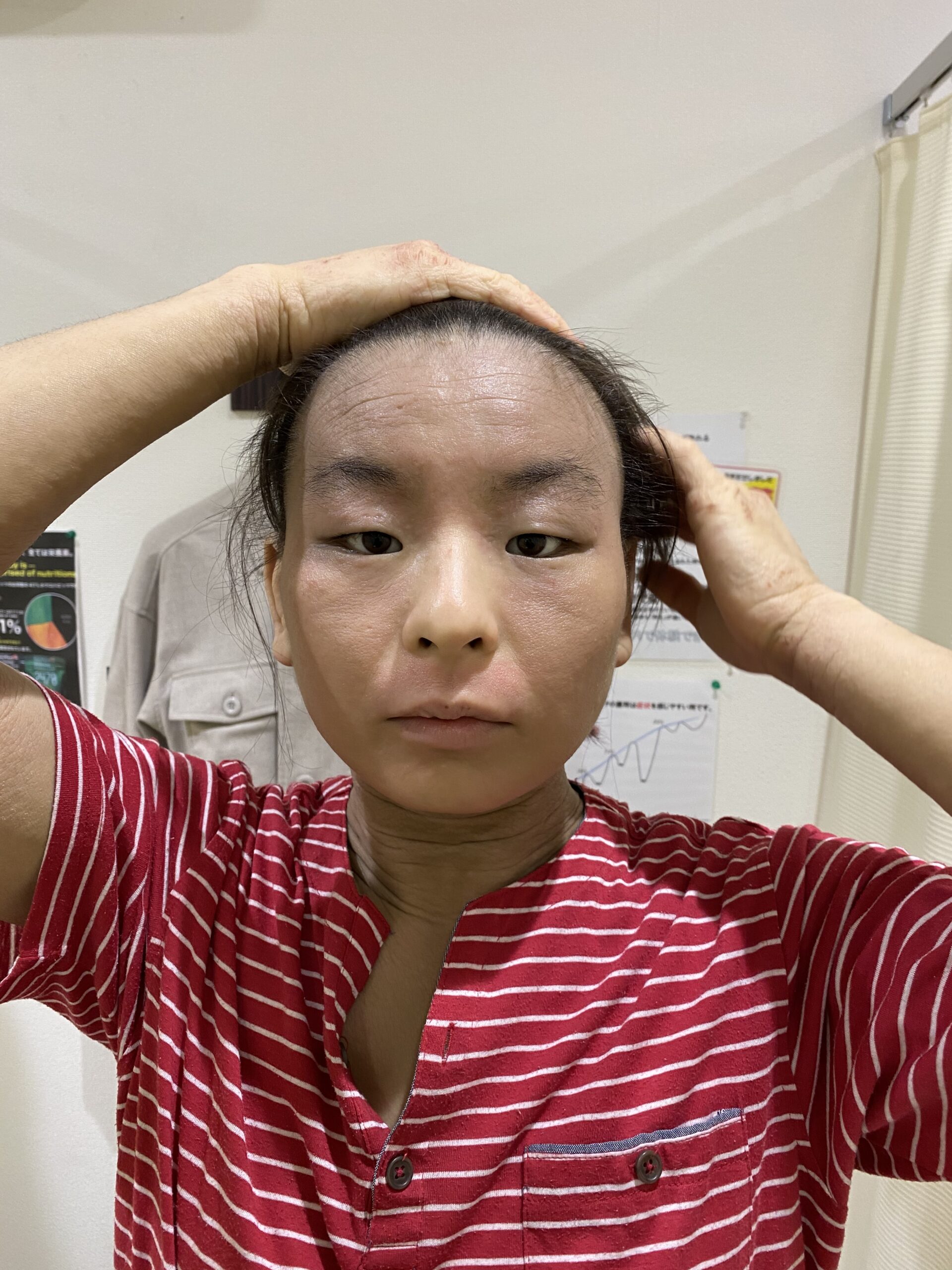 ビフォー写真