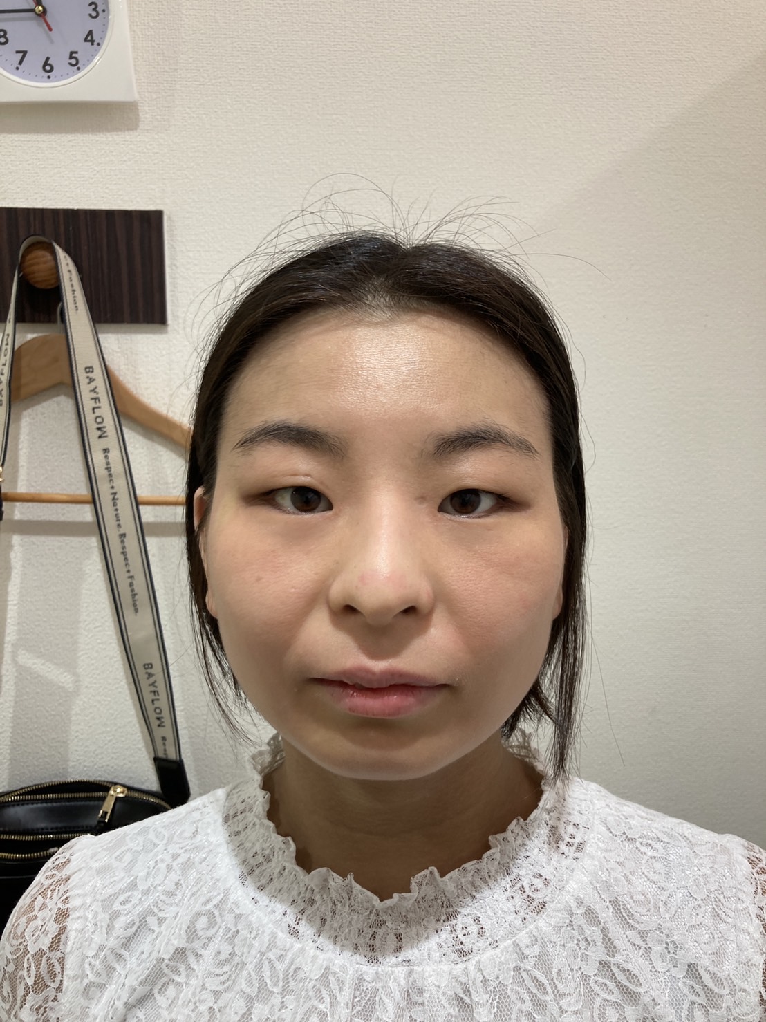 アフター写真