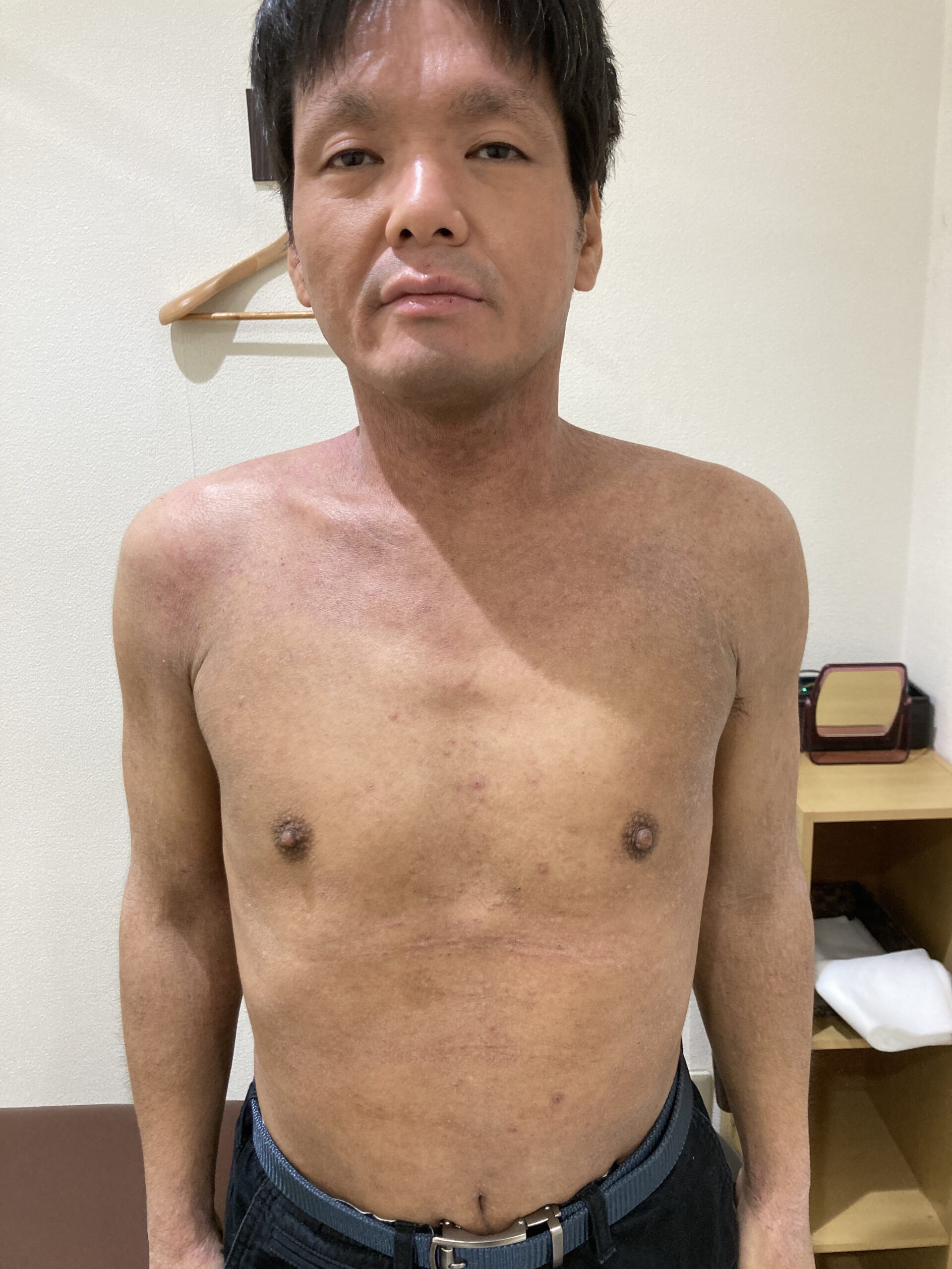 アフター写真