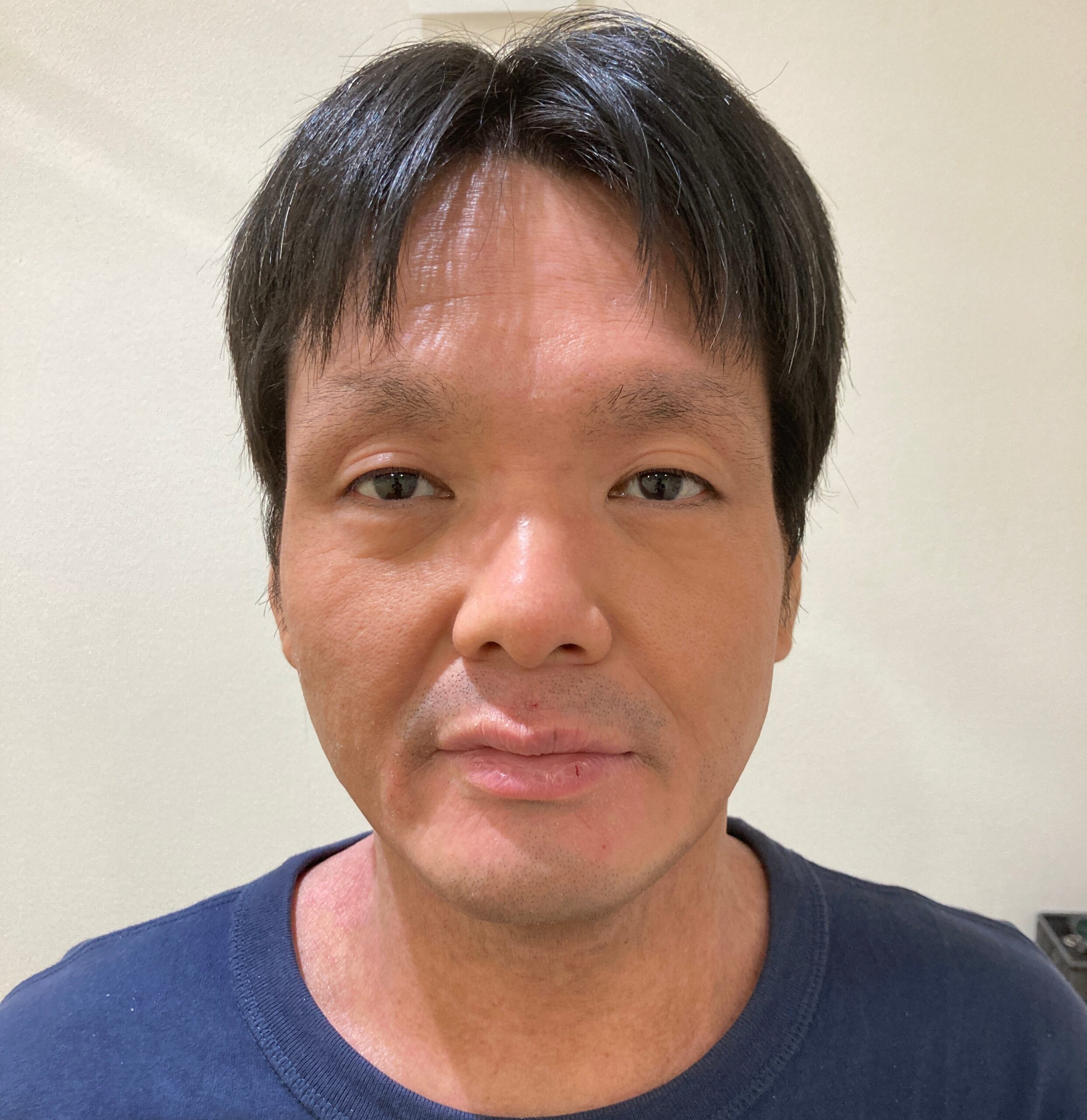 アフター写真