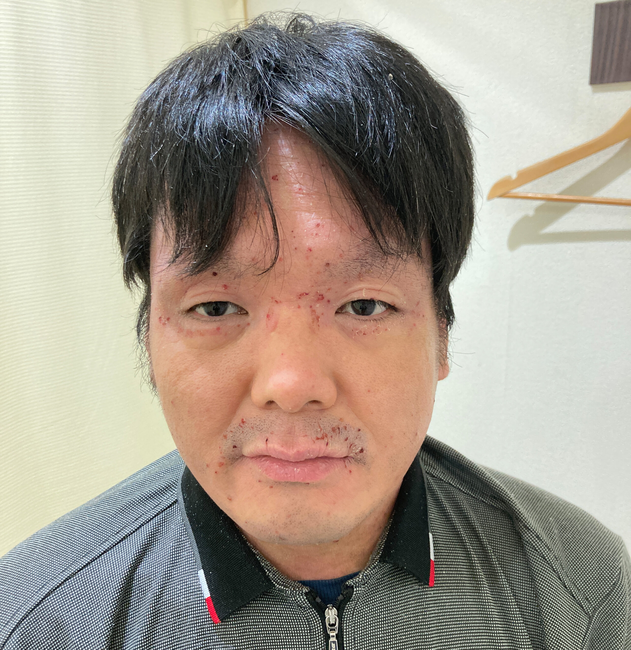 ビフォー写真
