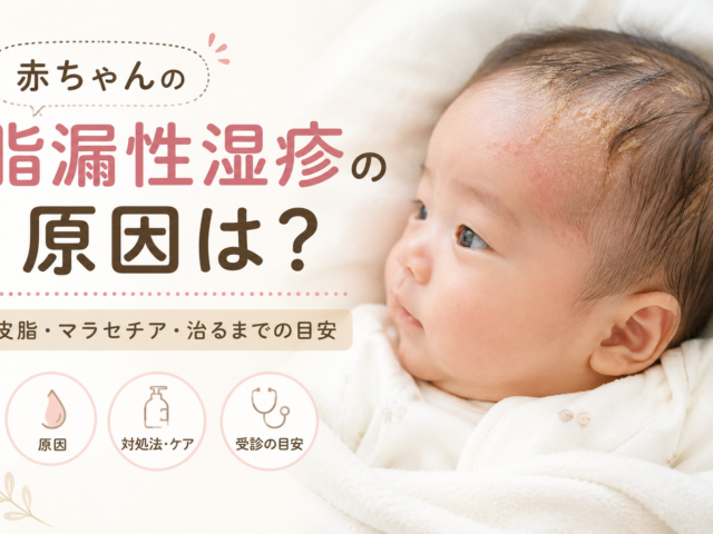 赤ちゃんの脂漏性湿疹の原因は？早く治すために知っておきたいこと