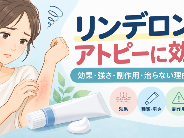 リンデロンはアトピーに効く？強さ・副作用・治らない理由を解説